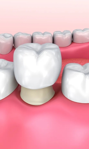 Restorative Dentistry